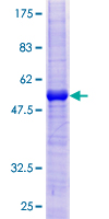 BAFF Receptor / CD268 Protein - 12.5% SDS-PAGE of human TNFRSF13C stained with Coomassie Blue