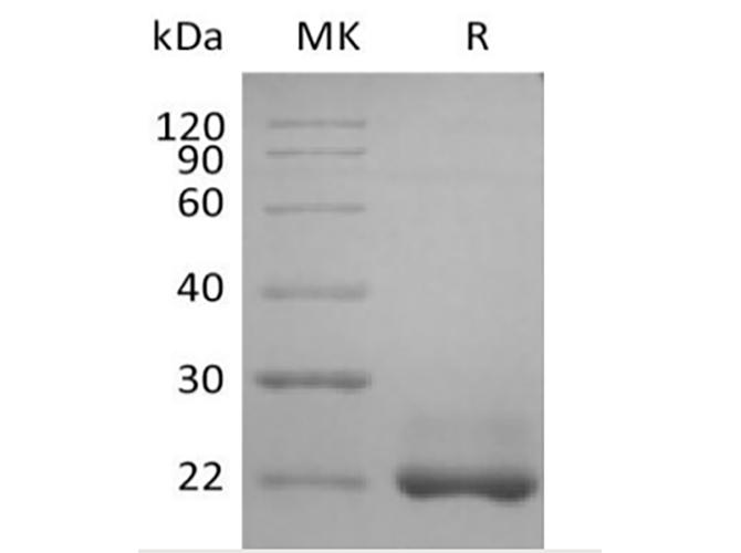 BAFF / TNFSF13B Protein - Recombinant Human TNFSF13B/BAFF/CD257 (N-6His)