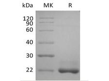 BAFF / TNFSF13B Protein - Recombinant Human TNFSF13B/BAFF/CD257 (N-6His)