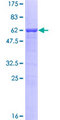 BAFF / TNFSF13B Protein - 12.5% SDS-PAGE of human TNFSF13B stained with Coomassie Blue