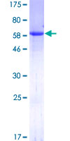 BAG1 / BAG-1 Protein - 12.5% SDS-PAGE of human BAG1 stained with Coomassie Blue