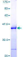 BAG1 / BAG-1 Protein - 12.5% SDS-PAGE Stained with Coomassie Blue.