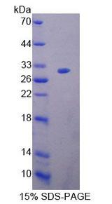BAG1 / BAG-1 Protein - Recombinant Bcl2 Associated Athanogene 1 (BAG1) by SDS-PAGE