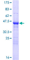 BAG2 Protein - 12.5% SDS-PAGE of human BAG2 stained with Coomassie Blue