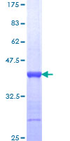 BAG2 Protein - 12.5% SDS-PAGE Stained with Coomassie Blue.