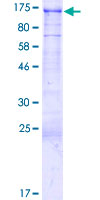 BAHD1 Protein - 12.5% SDS-PAGE of human BAHD1 stained with Coomassie Blue