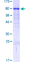 BAIAP2L1 Protein - 12.5% SDS-PAGE of human BAIAP2L1 stained with Coomassie Blue