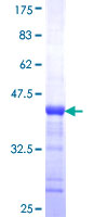 BAIAP2L1 Protein - 12.5% SDS-PAGE Stained with Coomassie Blue