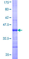 BAIAP3 Protein - 12.5% SDS-PAGE Stained with Coomassie Blue.