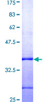 BAK1 / BAK Protein - 12.5% SDS-PAGE Stained with Coomassie Blue.