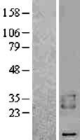 BAMBI Protein - Western validation with an anti-DDK antibody * L: Control HEK293 lysate R: Over-expression lysate