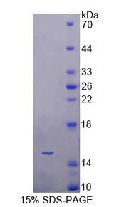 BAMBI Protein - Recombinant  BMP And Activin Membrane Bound Inhibitor Homolog By SDS-PAGE