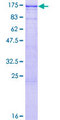 Band 4.1 / EPB41 Protein - 12.5% SDS-PAGE of human EPB41 stained with Coomassie Blue