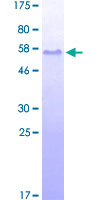 Band 4.1 / EPB41 Protein - 12.5% SDS-PAGE Stained with Coomassie Blue.