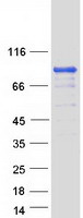 Band 4.1 / EPB41 Protein - Purified recombinant protein EPB41 was analyzed by SDS-PAGE gel and Coomassie Blue Staining