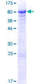 BANP Protein - 12.5% SDS-PAGE of human BANP stained with Coomassie Blue