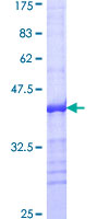 BAP1 Protein - 12.5% SDS-PAGE Stained with Coomassie Blue.