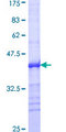 BAP1 Protein - 12.5% SDS-PAGE Stained with Coomassie Blue.