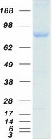 BAP1 Protein - Purified recombinant protein BAP1 was analyzed by SDS-PAGE gel and Coomassie Blue Staining