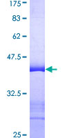 BAP29 / BCAP29 Protein - 12.5% SDS-PAGE Stained with Coomassie Blue.