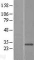 BAR / BFAR Protein - Western validation with an anti-DDK antibody * L: Control HEK293 lysate R: Over-expression lysate