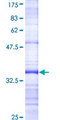 BAR / BFAR Protein - 12.5% SDS-PAGE Stained with Coomassie Blue.
