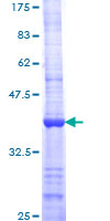 BARD1 Protein - 12.5% SDS-PAGE Stained with Coomassie Blue.