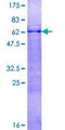 BARHL1 Protein - 12.5% SDS-PAGE of human BARHL1 stained with Coomassie Blue