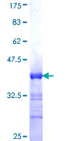BARHL1 Protein - 12.5% SDS-PAGE Stained with Coomassie Blue.