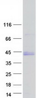 BARHL1 Protein - Purified recombinant protein BARHL1 was analyzed by SDS-PAGE gel and Coomassie Blue Staining