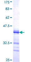 BARHL2 Protein - 12.5% SDS-PAGE Stained with Coomassie Blue.