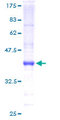 BARX1 Protein - 12.5% SDS-PAGE of human BARX1 stained with Coomassie Blue
