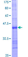 BARX2 Protein - 12.5% SDS-PAGE Stained with Coomassie Blue.