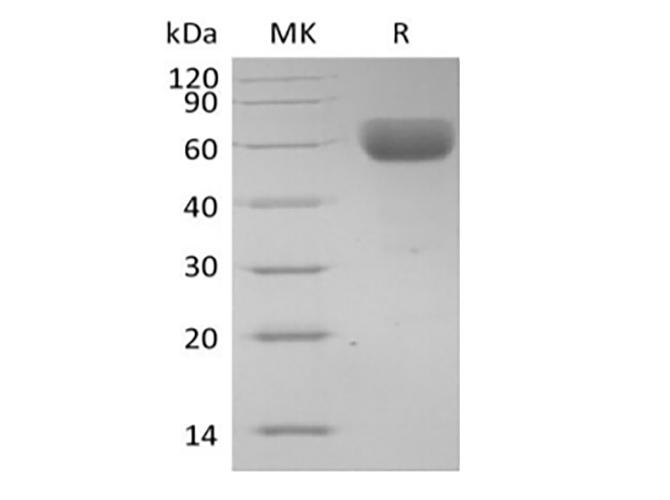 Basigin / Emmprin / CD147 Protein - Recombinant Human Basigin/CD147 (C-Fc)