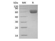Basigin / Emmprin / CD147 Protein - Recombinant Human Basigin/CD147 (C-Fc)