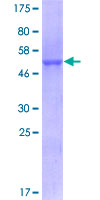 Basigin / Emmprin / CD147 Protein - 12.5% SDS-PAGE of human BSG stained with Coomassie Blue