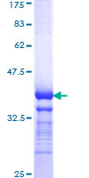 Basigin / Emmprin / CD147 Protein - 12.5% SDS-PAGE Stained with Coomassie Blue.
