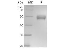 Basigin / Emmprin / CD147 Protein - Recombinant Human Basigin/CD147 (C-mFc)