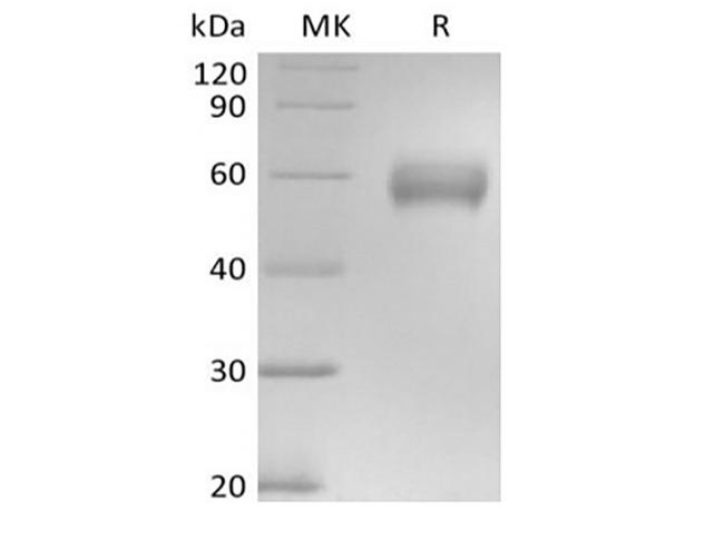 Basigin / Emmprin / CD147 Protein - Recombinant Human Basigin/CD147 (C-mFc)