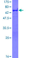 BASP1 Protein - 12.5% SDS-PAGE of human BASP1 stained with Coomassie Blue