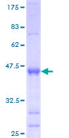 BATF2 / SARI Protein - 12.5% SDS-PAGE of human MGC20410 stained with Coomassie Blue