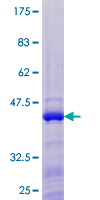 BATF3 Protein - 12.5% SDS-PAGE of human SNFT stained with Coomassie Blue