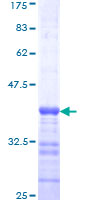 BAX Protein - 12.5% SDS-PAGE Stained with Coomassie Blue.