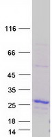 BAX Protein - Purified recombinant protein BAX was analyzed by SDS-PAGE gel and Coomassie Blue Staining
