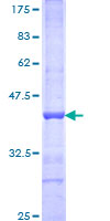 BAZ1A / ACF1 Protein - 12.5% SDS-PAGE Stained with Coomassie Blue.