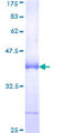 BAZ1B / WSTF Protein - 12.5% SDS-PAGE Stained with Coomassie Blue.