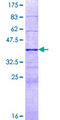 BAZ2A / TIP5 Protein - 12.5% SDS-PAGE Stained with Coomassie Blue.