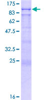 BAZ2B Protein - 12.5% SDS-PAGE of human BAZ2B stained with Coomassie Blue