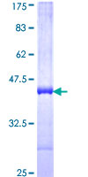 BBOX1 / BBOX Protein - 12.5% SDS-PAGE Stained with Coomassie Blue.