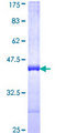 BBOX1 / BBOX Protein - 12.5% SDS-PAGE Stained with Coomassie Blue.
